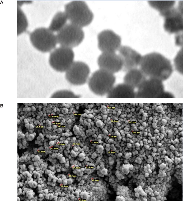 Transmission electron (A) and scanning electron (B) microscopy study of optimized nanoparticles