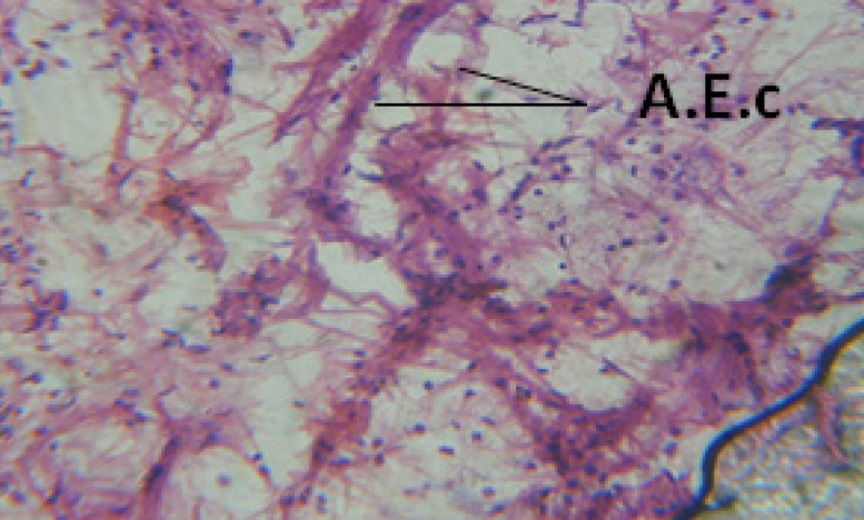 T.S. in treated B. alexandrina with 10 ppm fruits extract showing digestive epithelia. A.E.c: evacuated epithelial cells X = 200