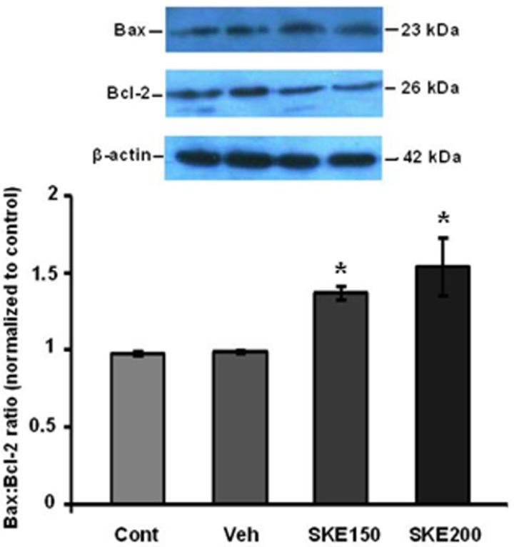 Effect of satureja khuzestanica extract (SKE) on levels of Bax and Bcl-2 protein expressions in MCF-7 cancer cell line. Bax and Bcl-2 protein levels were assayed by western blotting. *P < 0.05 significantly different versus control and vehicle-treated cells