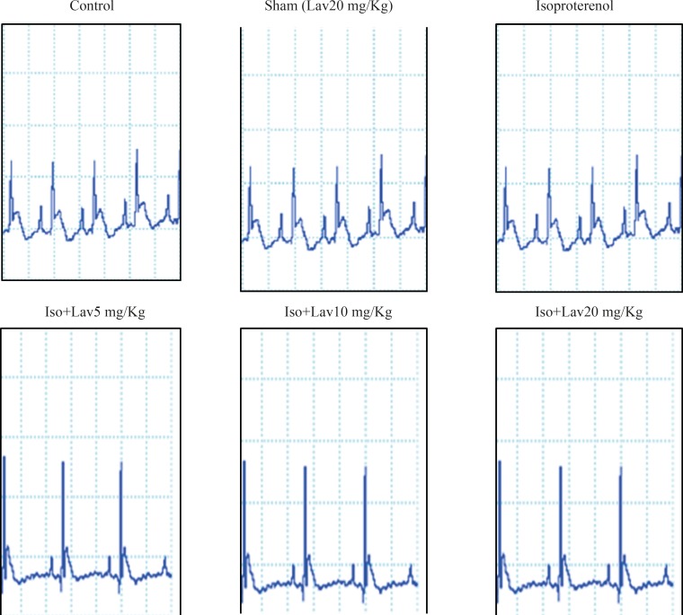 The effects of essential oil of L. angustifolia on electrocardiographic pattern and changes (recorded from limb lead II) in control, isoproterenol and Lavandula groups. Iso: Isoproterenol, Lav: L. angustifolia essential oil.