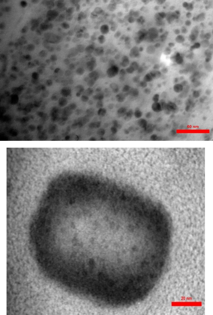 Morphology investigation of transfersomal lactoferrin by TEM