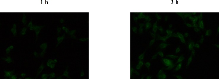 Fluorescent microscopic images of B16F10 cells after 1 and 3 h incubation at 37 °C with C6 loaded LNCs.