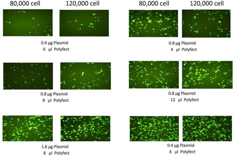 AGS cells were transfected by Polyfect reagent using different number of cellS and different amount of EGFP-plasmid and Polyfect reagent. 24 h. after transfection cells were examined for transfection efficiency by fluorescence microscopy