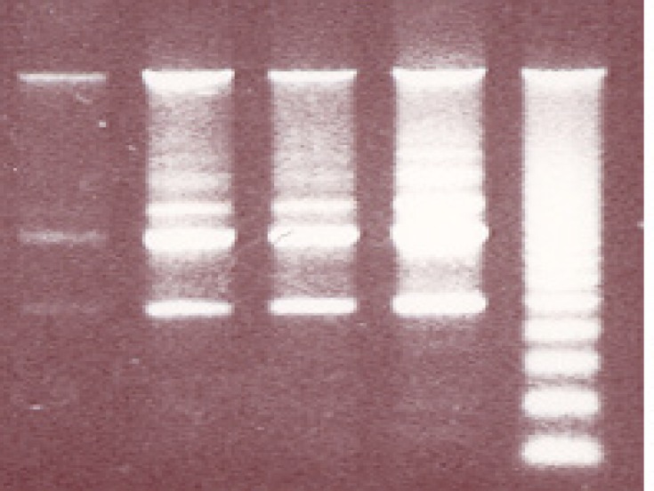 The effect of MPA on DNA fragmentation in PTO cells; In comparison with control remarkable differences are observed between the given concentrations of MPA following 24 h exposure to MPA. R indicates reference sample.