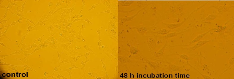 Microscopic view of 1321 cell line in the absence and presence of LC50 concentration of filtered leaf extract at 48 h incubation time