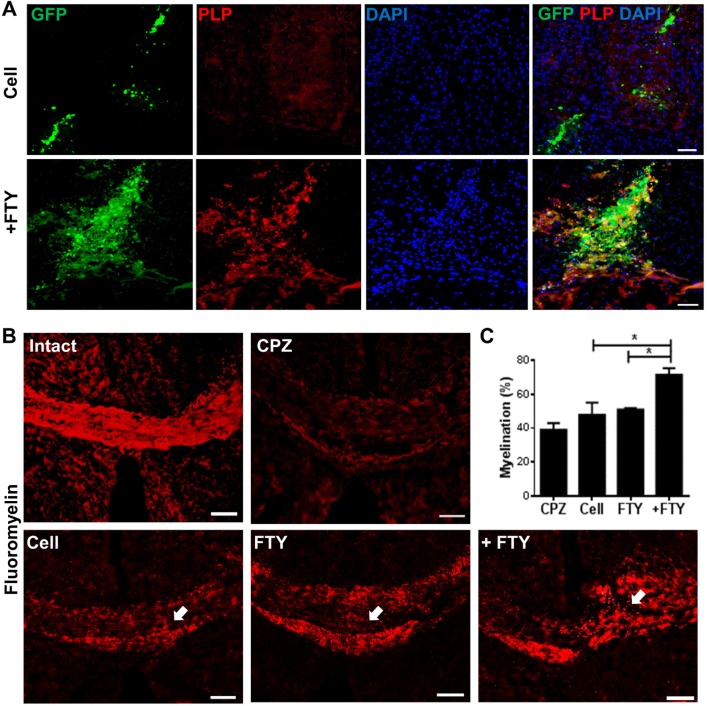 Evaluation of the effect of fingolimod on remyelination efficacy of transplanted neural progenitors (NPs). (A) Transplanted NPs expressed PLP as a mature oligodendrocyte marker at dpt 21. (B) FluoroMyelin™ staining showed the extent of myelination at dpt 21 at the injection site (arrows). (C) Quantification analysis of the extent of myelination at the cell injection site. *P < 0.05; +FTY: Animals that received fingolimod and NPs; CPZ (as control): Animals that received cuprizone for 10 weeks; FTY: Animals that received fingolimod without cell transplantation; Scale bar in (A): 50 µm and (B): 100 µm. GFP: Green fluorescence protein (reporter gene); DAPI: Nuclei stain; PLP: Mature oligodendrocyte marker; dpt: Day post-transplantation. Arrows represent the cell injection site. n = 3