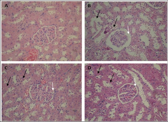Effect of pravastatin on ADR-induced nephropathy rats. Microscopic slide of rat kidney (H and E × 300). (A) Control group with normal structure of glomeruli and cortical tubules and (B) ADR group with degeneration of the epithelial cells of some tubules (black arrow) and dilated bowman’s space (white arrow). (C and D) Pravastatin administration reduced these changes