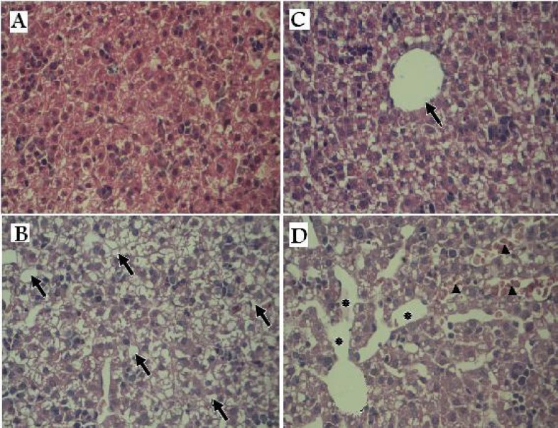 Histopathology of liver tissues in offspring rats exposed prenatally to vehicle or AgNPs. (A & C) control group: Normal hepatic lobule and hepatocytes surrounding a central vein (arrow). (B & D) treated group: Arrows indicate vacuolated appearance (B).Asterisks denote the massive destination in the sinusoid space and arrows indicate congested hepatic sinusoids containing red blood cells. (×100