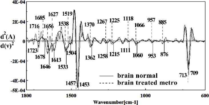 Second derivative of mean FTIR spectra of normal (solid line) and Metronidazole-treated (dot line) brain sections in the 600–1800 cm–1 wave number region