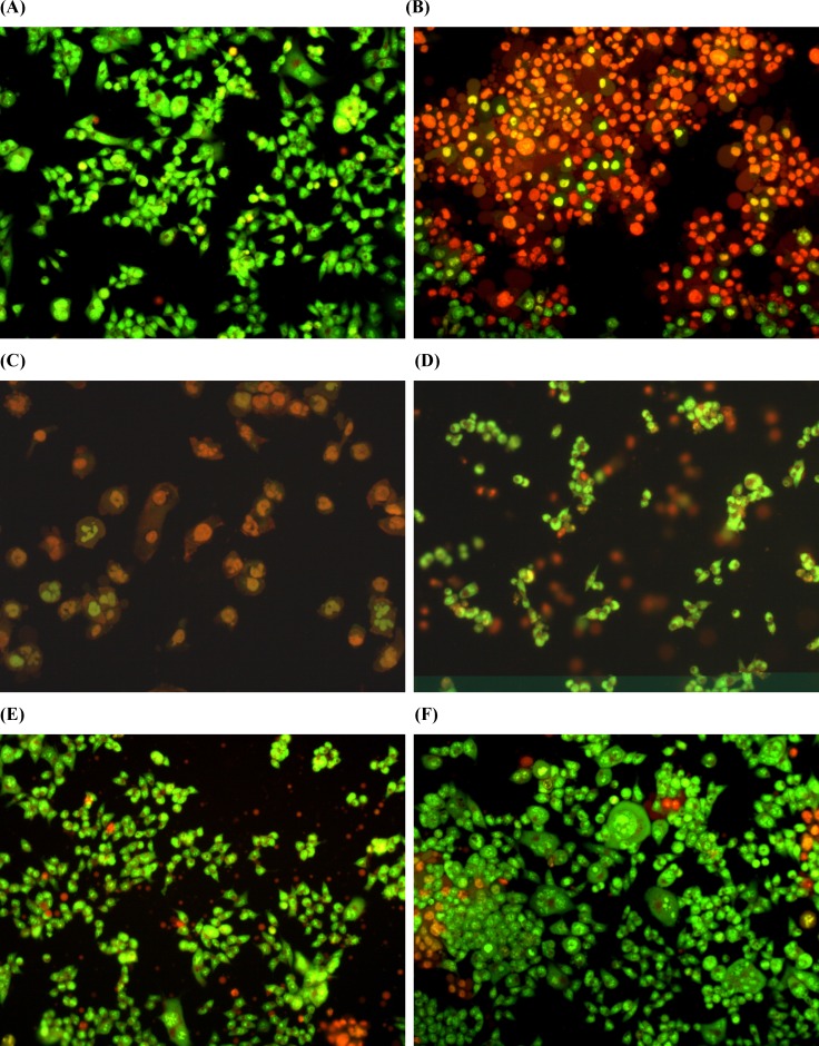 Estimation of apoptosis after 18 h of pretreatment with 1,9-P liposomes and incubated with 6-OHDA (150 µM) for 6 h cells with AO/EB staining were observed under fluorescence microscope. (A) Control with vehicle treatment; (B) 6-OHDA (150 µM) treated; (C) 6-OHDA (150 µM) + 1,9-P liposome 1 µg/mL; (D) 6-OHDA (150 µM) + 1,9-P liposome 2.5 µg/mL; (E) 6-OHDA (150 µM) + 1,9-P liposome 5 µg/mL; (F) 6-OHDA (150 µM) + 1,9-P liposome 10 µg/mL