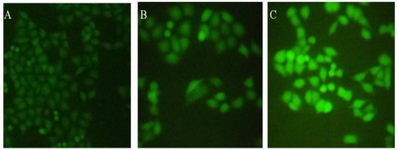 Effect of brittle star saponin fraction on intracellular ROS generation in Hela-S3 human cancer cells treated with brittle star saponin using fluorescence microscopy. A) untreated cells, B) 12.5 μg/ml, C) 25 μg/ml saponin treated cells. ×200