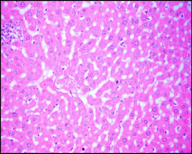 Photomicrograph of liver of mice (H&E, 400×) from + ve control (Cd) group showing cytoplasmic vacuolization and necrosis of hepatocytes