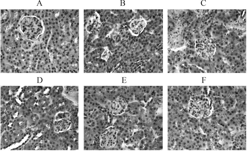 PTP1B expression in kidney tissue. (IHC, ×200). A: Normal group B: Model group. C: BNPL group. D: L-TFBFL group. E: M-TFBFL group. F: H-TFBFL group
