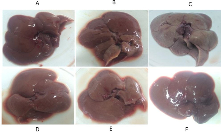 Morphological changes. (A) Liver section in the normal rat. (B) Silymarin treated rats, (C) CCl4-intoxicated rats, (D) Extract (75 mg/kg) treated rats, (D) Extract (150 mg/kg) treated rats, (D) Extract (300 mg/kg) treated rats