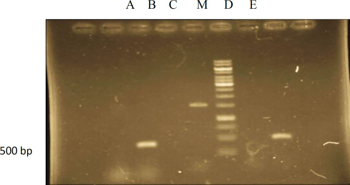 PCR analysis of hairy root culture of Atropa komarovii transformed Agrobacterium rhizogenes ATCC 15834. lane M –Marker (1kbp): lane A- genomic DNA of hairy root culture showing amplified fragment of rolB (500bp): lane B- genomic DNA from normal root culture (negative control): lane C- PCR(positive control): lane D - PCR (negative control): lane E- genomic DNA of hairy root culture showing amplified fragment of rolB (500bp).