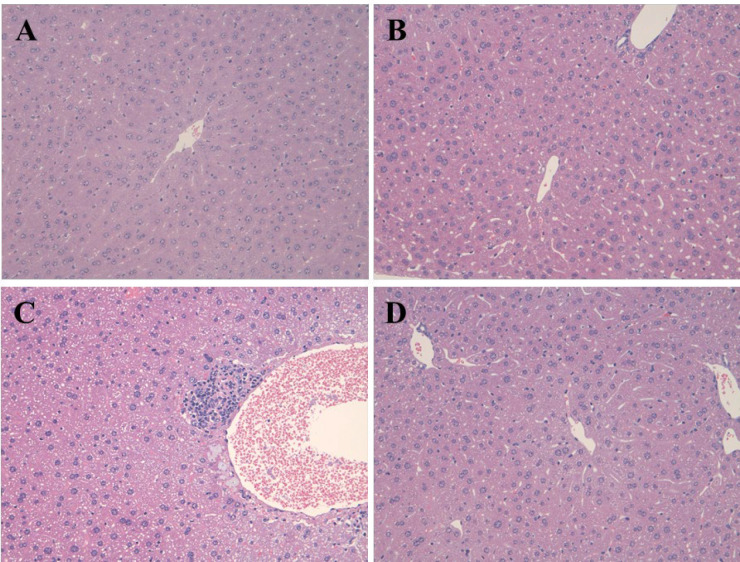 Photomicrophs (original magnification × 200) of H&E-stained livers in rats