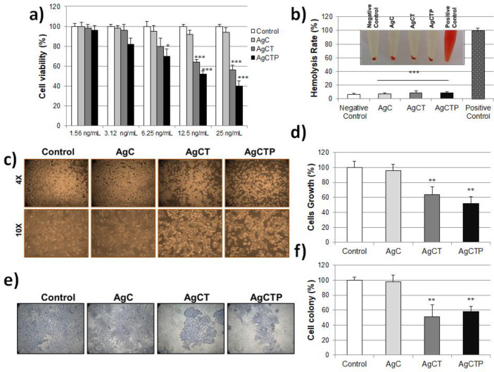 (a) Cell viability measurement with MTT assay after AgCT NPs treatment (1.56–25 ng/mL) of HT-29 cell lines for 24 h. (b) In-vitro hemolysis assay of AgNPs in red blood cells. The ratio of hemolysis in red blood cells with treated AgCT NPs (***p ˂ 0.001 compare to positive control). Effect of AgCT NPs (25 ng/mL) on the cell survival in HT-29 human colon cancer cells for 24 h (c) Cell morphological changes (d) Ratio of cell growing (**p ˂ 0.01 compare to control) (e) Cell colony formation stained with crystal violet (f) Ratio of cell colony (**p ˂ 0.01 compare to control) (Results are representative of three biological replicates).