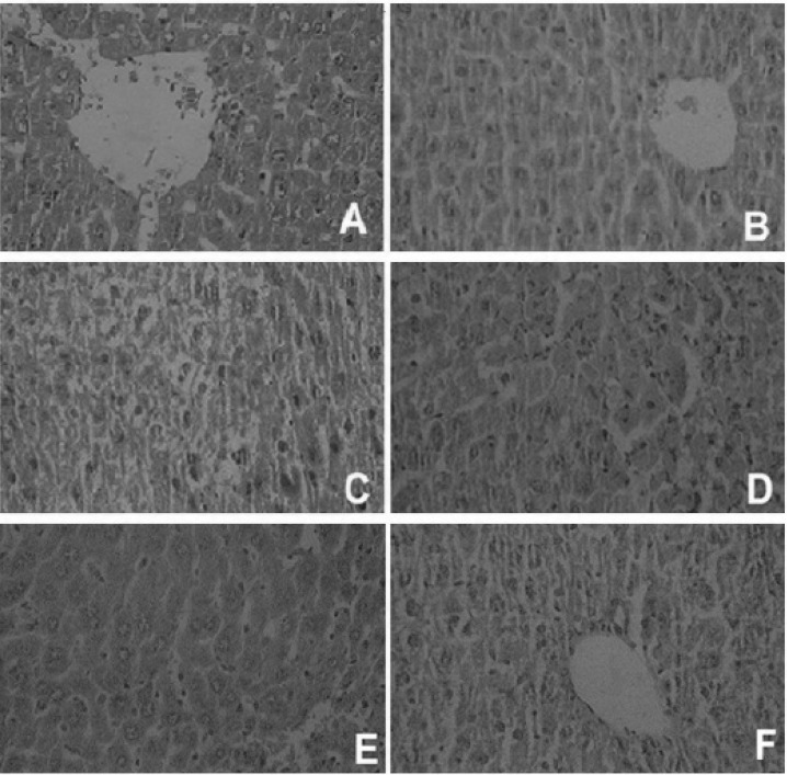 Histopathological observations (liver sections stained with Hematoxylin and Eosin, magnification x 100) showing the effects of Teucrium polium extract on acetaminophen-induced histopathological changes in mouse liver. (A) Normal, (B) T. polium L. extract (500 mg/Kg) shows normal hepatic architecture with distinct hepatic cells, sinusoidal spaces and a central vein; (C) acetaminophen-treated group shows severe centrilobular hepatic necrosis, fatty changes, ballooning degeneration, and infiltrating lymphocytes; (D), (E) and (F) are acetaminophen groups pre-treated with 125, 250 and 500 mg/Kg of T. polium L extract, respectively. D shows milder degree of hepatocyte necrosis, fatty changes, ballooning degeneration, and infiltrating lymphocytes. In pictures E and F, only mild inflammation and lymphocyte infiltration are observed