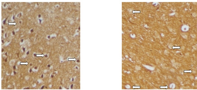Histopathological evaluation of spinal cord by Bielschowsky's stain. Relatively normal axons (left) after treatment with high-dose Ro 25-6981 and axonal loss (right) in non-treated EAE mice