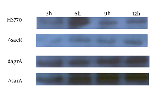 Expression of sasX in S. aureus clinical isolates and deletion mutant. sasX gene expression in S. aureus HS770, HS770ΔsaeRS, HS770ΔsarA and HS770ΔagrA deletion mutant in different growth time points was detected using Western blot with anti- sasX antibody (1:1000).
