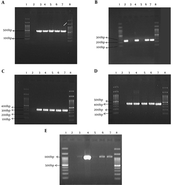A: OXA23; B: OXA24; C: OXA51; D: ISAba1; E: ISAba2. Band 1 and 8: Ladder; Band 2: negative; Band 7: positive; Bands 3 - 6: PCR products of related genes.