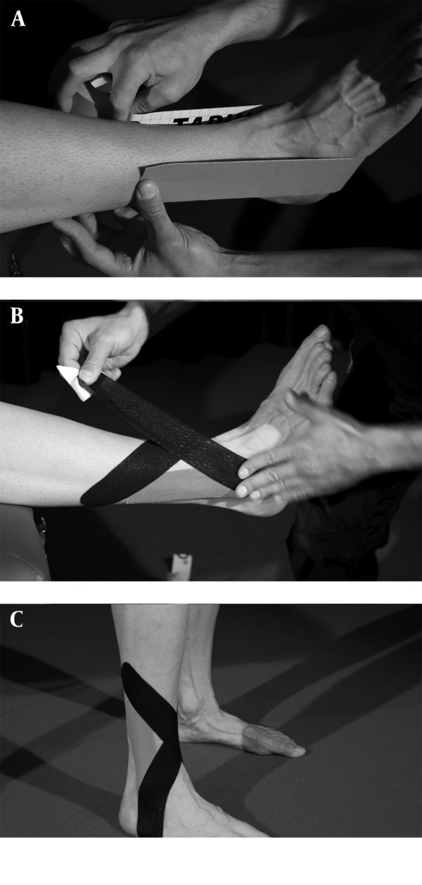 Placement of the Neuromuscular Tape on Subjects (A, B, and C).