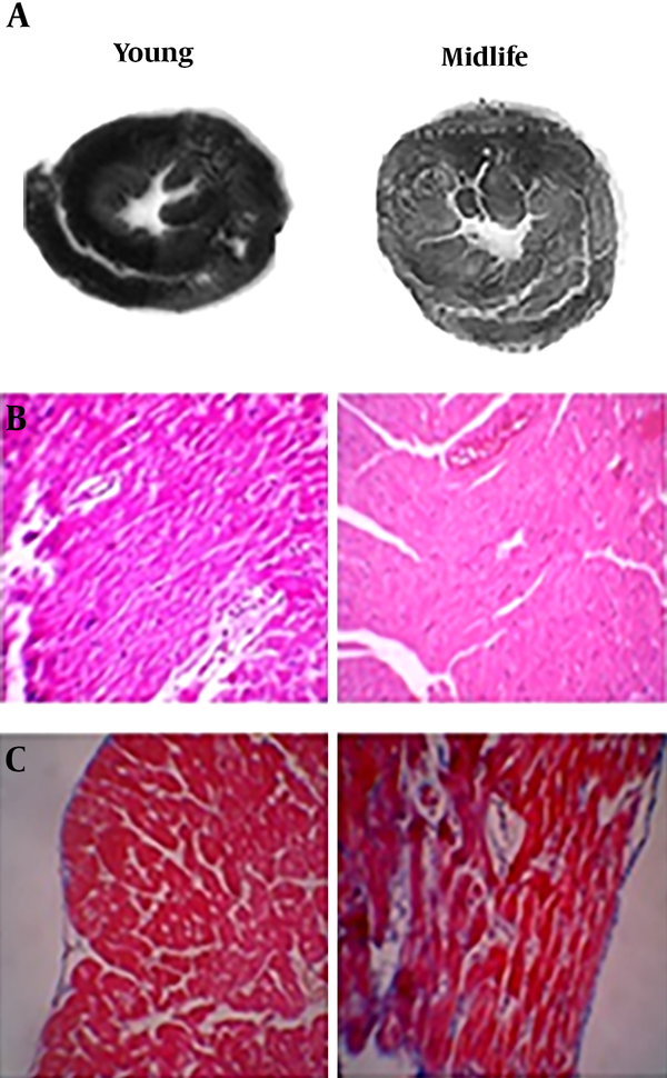 The effect of midlife on the dimensions and tissue of the rat heart. A, comparison of heart dimensions in young and midlife; B, hematoxylin-eosin (HE) stained thin cut section of the heart ventricle; C, Mason-Trichrome coloring basis.