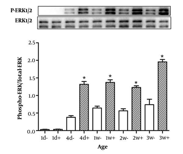 Rats were injected by growth hormone (2 mg/kg of body weight) (filled bars) or saline (open bars) in the inferior vena cava and sacrificed after 25 min. Then, the livers were removed. Equal amounts of protein were analyzed by Western blot. The figures are at least three separate experiments, and data are the mean ± SD of three independent experiments.