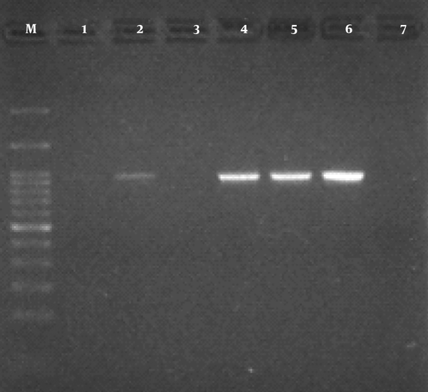 Electrophoresis of CTX-M-1 gene PCR product on 2% agarose gel; lane M: a 100-bp ladder; lane 1, 2, 4, and 5: positive samples; lane 3: negative sample; lane 6: positive control; lane 7: negative control.