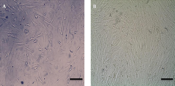 Image of differentiated cells since 21days post induction. A, morphological variations of human endometrial stem cells. hEnSCs after passage3 showed spindle-shape morphologies, similar to fibroblasts. B, 21 days after osteogenic exposing cells that converted to osteoblast like cells. Scale bar = 100 µm.