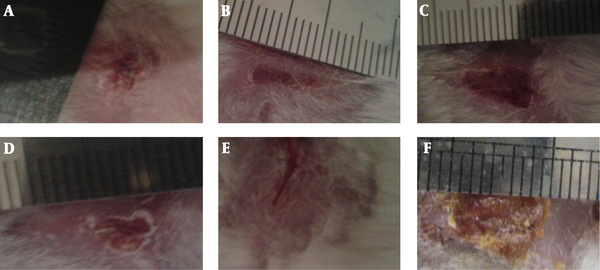 Macroscopic images taken from the burn wounds 28 days after burning in the treatment groups. A, Sesamum 40%; B, Sesamum 30%; C, Cucurbita 40%; D, Cucurbita 40%; E, Sesamum 50% + Cucurbita 50%; F, Non-treated control group.