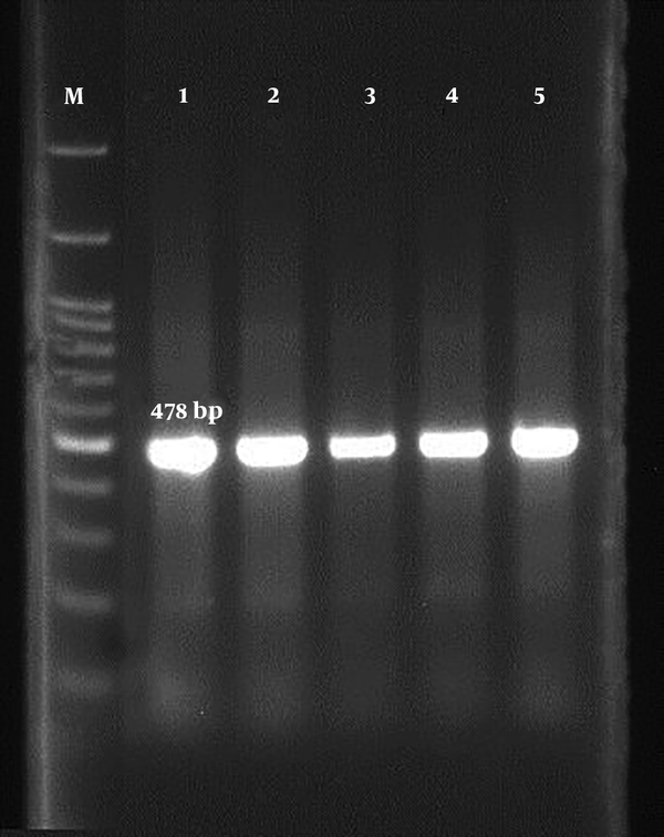 Positive results of OXa gene in Escherichia coli