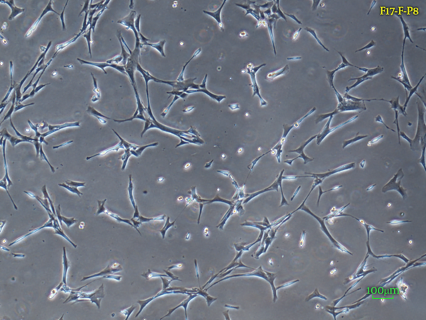 40X Inverted light microscopy of fetal dermal fibroblasts morphology