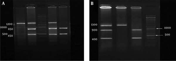 The PCR-RFLP analysis results of A. PvuII T&gt; C and b. XbaI A&gt; G polymorphisms of ERα gene