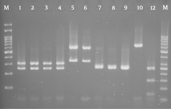 Agarose gel electrophoresis of restriction fragments length polymorphism ITS gene from Candida species isolated from vulvovaginal candidiasis with Candida albicans (lanes 1 - 4), C. glabrata (lanes 5 - 6), C. krusei (lanes 7 - 9), C. kefyr (lane 10), and Lane M represents a 100 bp size molecular marker.