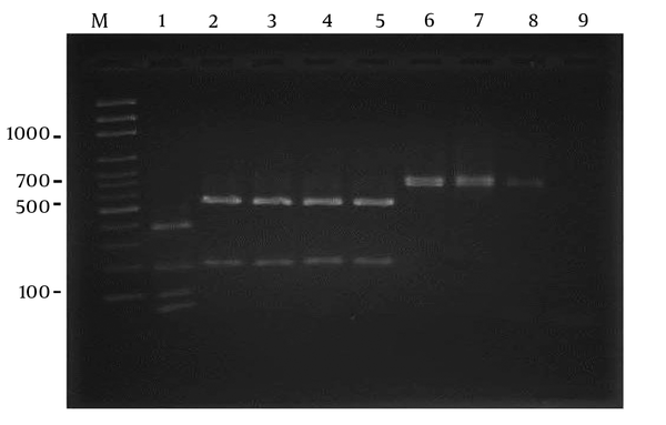 RFLP pattern of PCR products obtained from Candida parapsilosis sensu lato strains after digestion with BanI restriction enzyme. Lane M: molecular size marker 100-bp. lane1: Candida metapsilosis (standard), lane 2: Candida parapsilosis  sensu stricto (standard): lanes 3 - 5 clinical samples; lanes 6–8: Candida orthopsilosis (clinical samples); lane 9: negative contro.