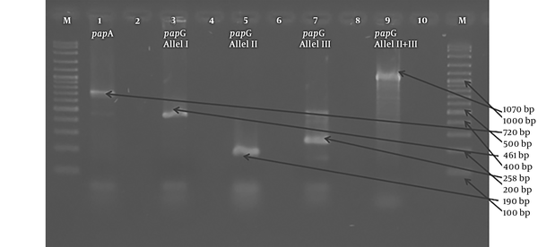 The gel electrophoresis images of the pap genes. 1: papA positive isolate (720 bp) 3: papG allele I positive isolate (461 bp) 5: papG allele II positive isolate (190 bp) 7: papG allele III positive isolate (258 bp) 9: papG allele II - III positive (1070 bp) 2 - 4 - 6 - 8: negative control (mastermix without DNA) M: 100 bp DNA ladder (Vivantis®)