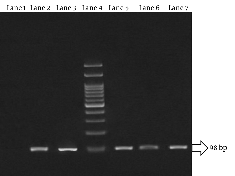 Lane 1, negative control; lane 2, 5, 6, 7, qPCR products of unknown tissue samples; lane 3, positive control (standard DNA extracted from RH-strain tachyzoites); lane 4, DNA molecular weight marker (100 bp).