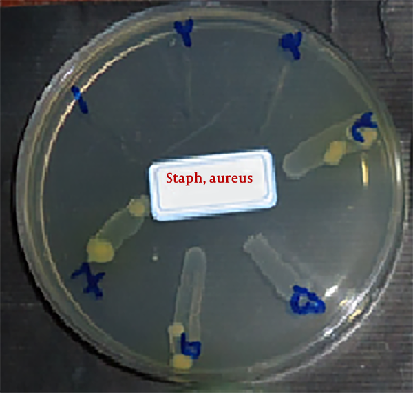 The result of MBC on Staphylococcus aureus