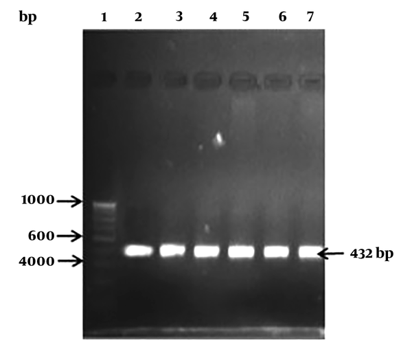 Detection of neuraminidase gene among isolates of Listeria monocytogenes *lane 1: 1000 bp DNA molecular ladder; lane 2: ATCC 19155; lane 3: L. monocytogenes L-123; lane 4: L-14; lane 5: L-187; lane 6: L-44; lane 7: L-88