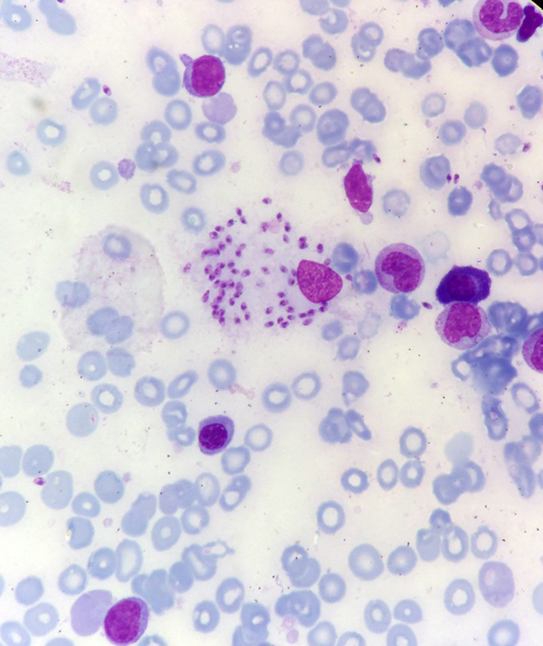 Leishman bodies within macrophages