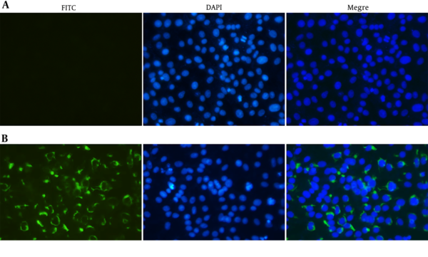 Indirect immunofluorescent assay of the E protein in Vero cells infected with ZIKV. ZIKV infected (B) and mock-infected (A) Vero cells were probed with the E antiserum and observed under fluorescent light. ZIKV infected and mock-infected Vero cells were counterstained with DAPI to visualize the nuclei (40×).