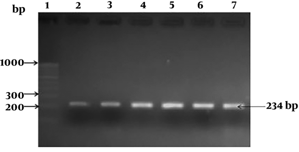 PCR detection of hlyA gene among Listeria monocytogenes *lane 1: 1000 bp DNA ladder; lane 2- L. monocytogenes ATCC 19155; lane 3-7: L. monocytogenes isolate L-123, L-14, L-187, L-44, L-88