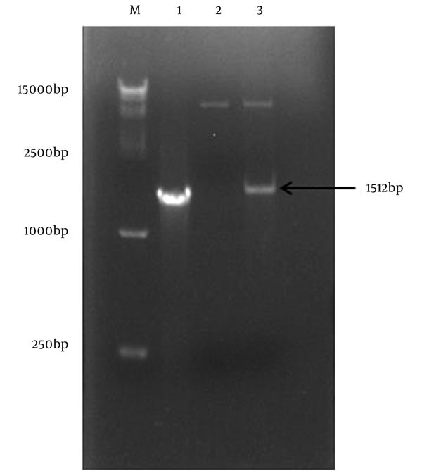 Amplification of ZIKV E protein gene. M: DL15000 DNA marker; lane 1: E protein fragment; lane 2: The pET-32a digested by EcoR I and Xho I Enzymes; lane 3: The pET-32a-ZIKV-E digested by EcoR I and Xho I Enzymes.