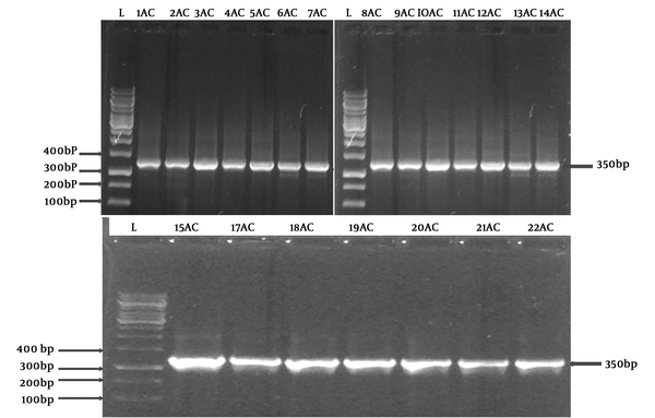 Detection of blaOXA-51 gene using PCR. A electrograph of a representative agarose gel (1.2% wt/vol %) showing the PCR products. L refers to a100 bp DNA size marker ladder while the amplified fragments of A. baumannii isolates appeared in other lanes. The amplicons showed up on the predicted size of the blaOXA-51 gene (350 p).