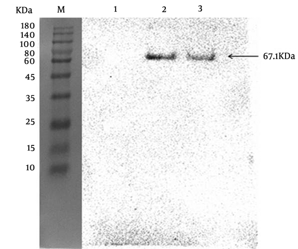 Western Blot analysis of ZIKV-E protein. Lane M: marker; lane 1: E. coli before induced; lane 2: E. coli was induced with IPTG; lane 3: the purified ZIKV-E protein after dialysis.