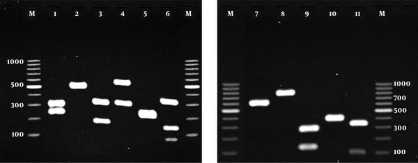 Agarose gel electrophoresis of ITS-PCR products of yeasts species after digestion with MspI; lanes 1 - 11: C. albicans, C. parapsilosis, C. tropicalis, C. glabrata, C. krusei, C. guilliermondii, C. famata, C. kefyr, C. intermedia, C. haemulonii and C. sorbosivorans, respectively; Lane M: a 100-bp DNA size marker