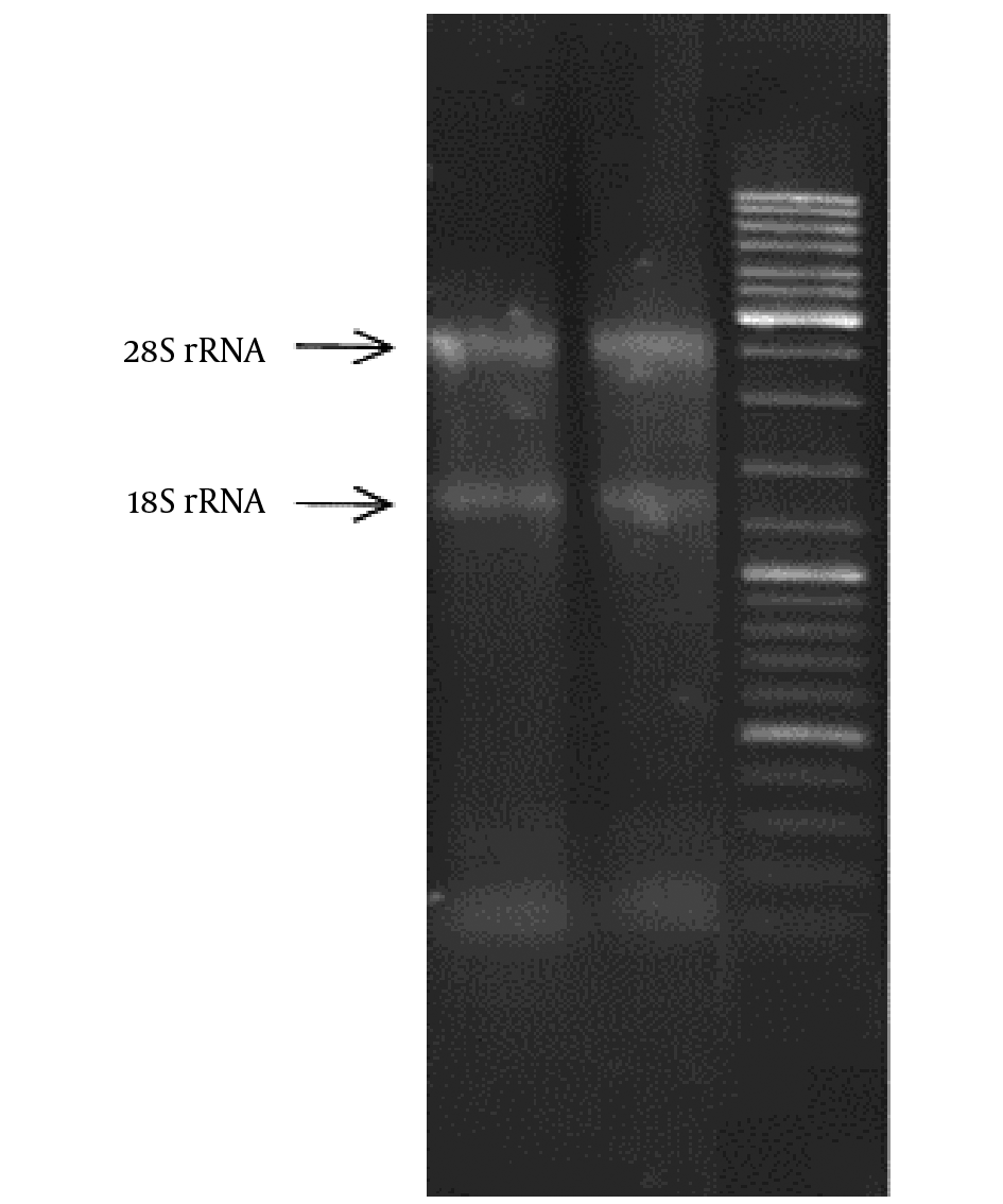 Total RNA isolated from clinical specimens on 1% agarose gel image