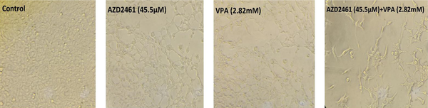 Morphological alterations of Hela cells treated with IC50 values of AZD2461, VPA, and their combination following 48 hours of incubation. A reduction in the viability of AZD2461/VPA treated cells is evident compared to Hela untreated cells.