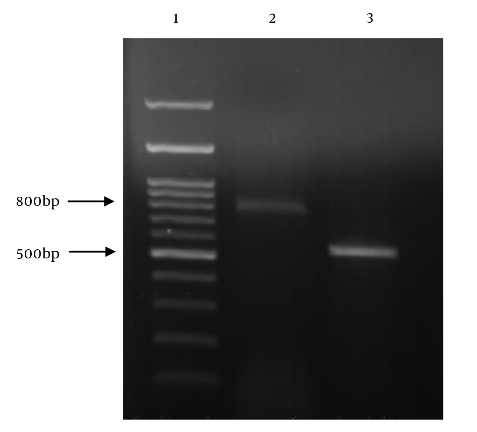 PCR amplification of IMP-type and VIM-type MBLs of P. aeruginosa isolates. Lane 1: DNA size marker; Lane 2: blaVIM positive isolate; Lane 3: blaIMP positive isolate